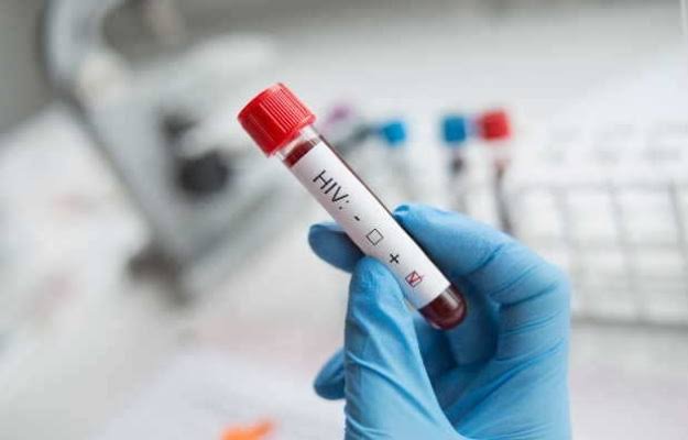 रामनगर में नशेड़ी युवती के संपर्क में आने से 20 से ज्यादा HIV पॉजिटिव